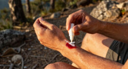 4 Best Bleeding Control Powders in 2026